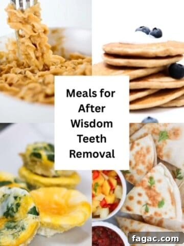 Four images of food with text in the center, "Meals for After Wisdom Teeth Removal."